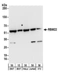 Detection of human and mouse RBM22 by western blot.