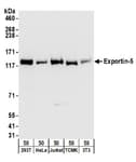 Detection of human and mouse Exportin-5 by western blot.