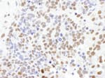 Detection of mouse SF1 by immunohistochemistry.
