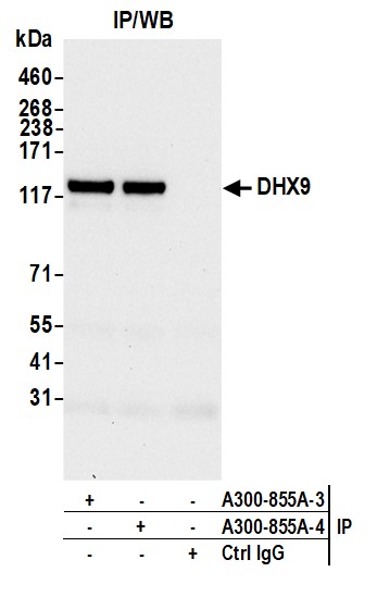 Detection of human DHX9 by western blot of immunoprecipitates.