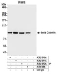 Detection of human beta Catenin by western blot of immunoprecipitates.