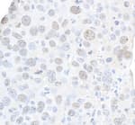 Detection of Mouse gamma-H2AX by Immunohistochemistry.
