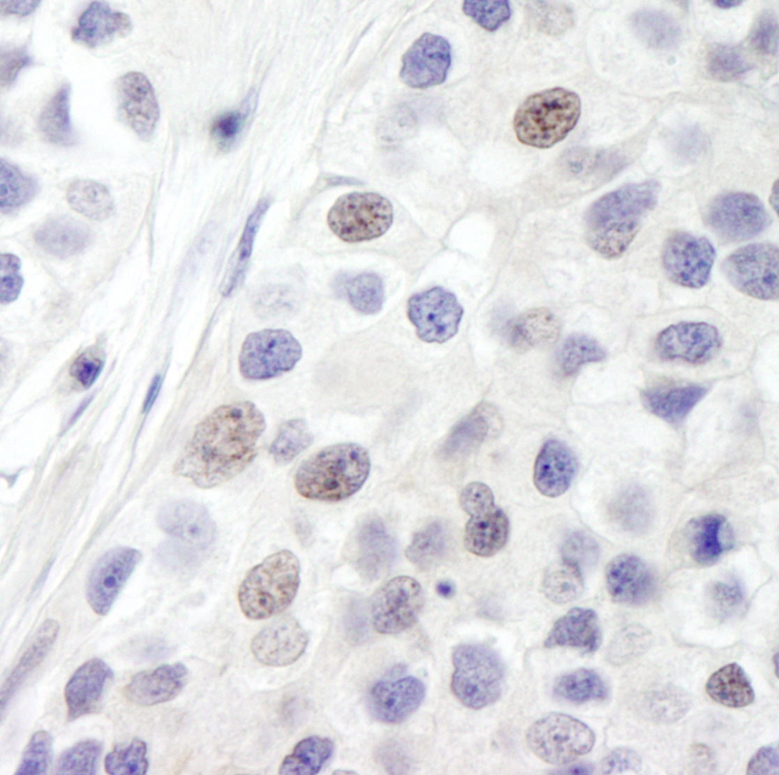 Rabbit anti-INT8 IHC Antibody
