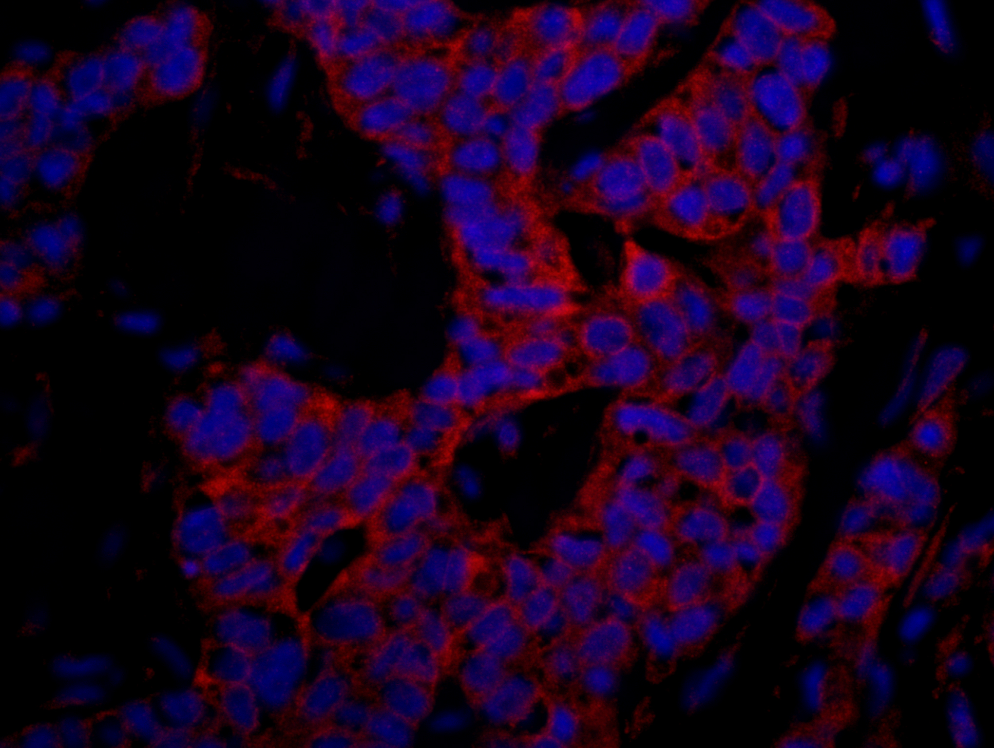 Rabbit anti-p600 IHC Antibody