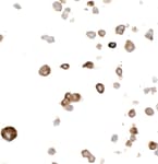 Detection of Myc Tag in FFPE HEK293 cells expressing Myc-tagged cytoplasmic protein by ICC.