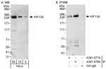 Detection of human KIF13A by western blot and immunoprecipitation.