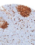 Detection of human TS by immunohistochemistry.