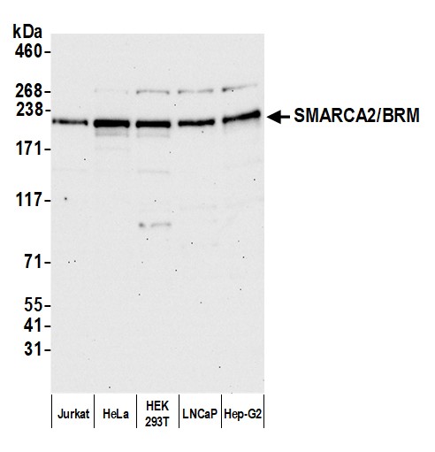 Detection of human SMARCA2-BRM by western blot.