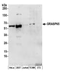 Detection of human and mouse GRASP65 by western blot.