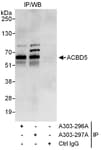 Detection of human ACBD5 by western blot of immunoprecipitates.