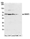 Detection of human and mouse SMAP2 by western blot.