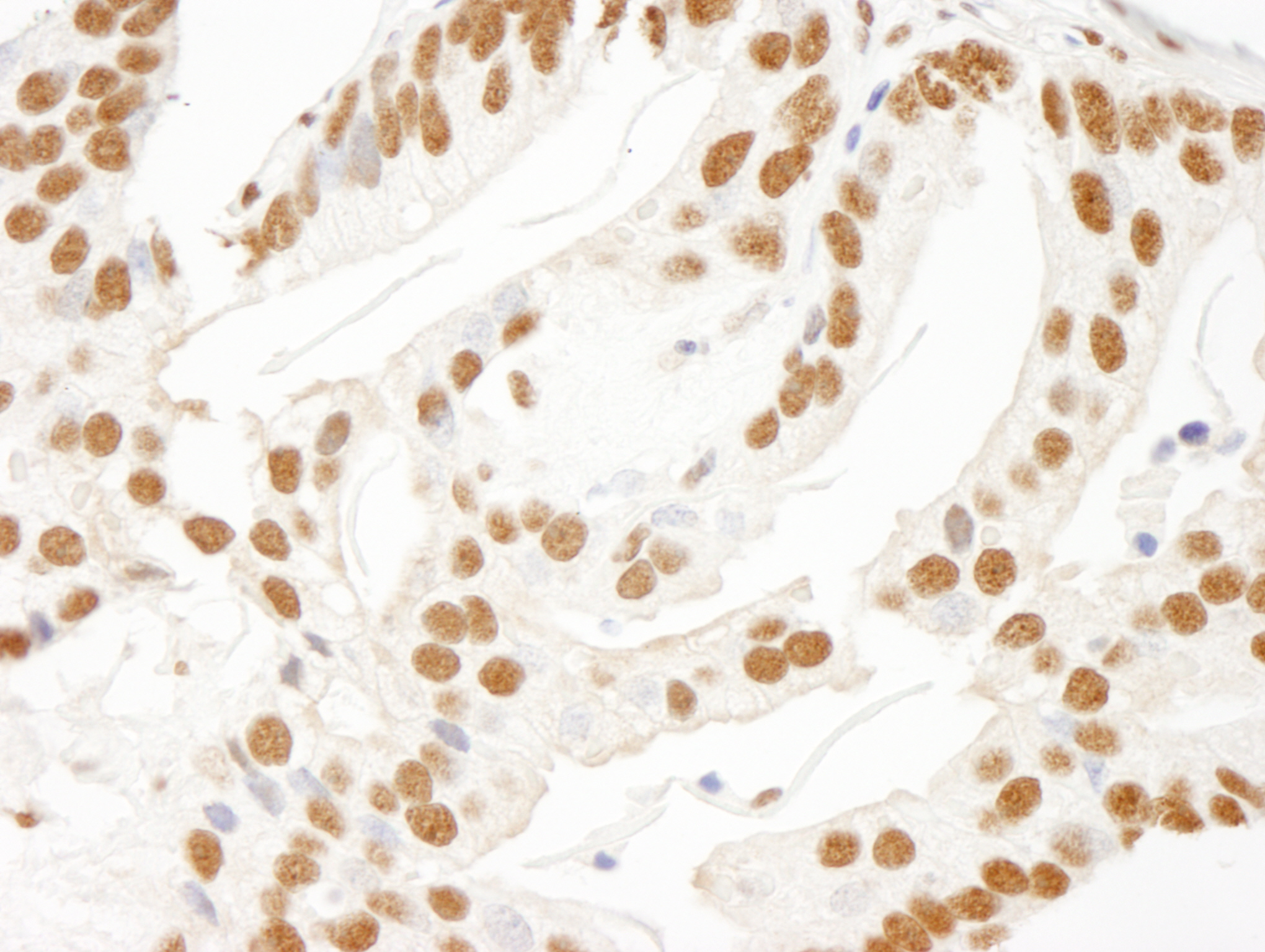 Rabbit anti-KSRP IHC Antibody