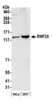Detection of human RNF20 by western blot.