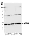 Detection of human and mouse ARPC3 by western blot.