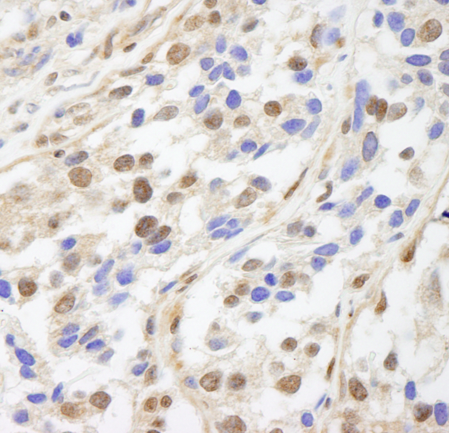 Rabbit anti-UACA IHC Antibody