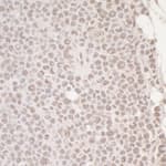 Detection of mouse OCT1 by immunohistochemistry.