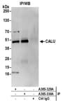 Detection of human CALU by western blot of immunoprecipitates.