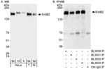 Detection of human and mouse ErbB2 by western blot (H &amp; M) and immunoprecipitation (H).
