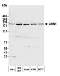 Detection of human XRN1 by western blot.