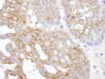 Detection of human IL14 by immunohistochemistry.