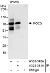 Detection of human POC5 by western blot of immunoprecipitates.