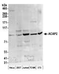 Detection of human and mouse ACAP2 by western blot.