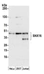 Detection of human SNX16 by western blot.