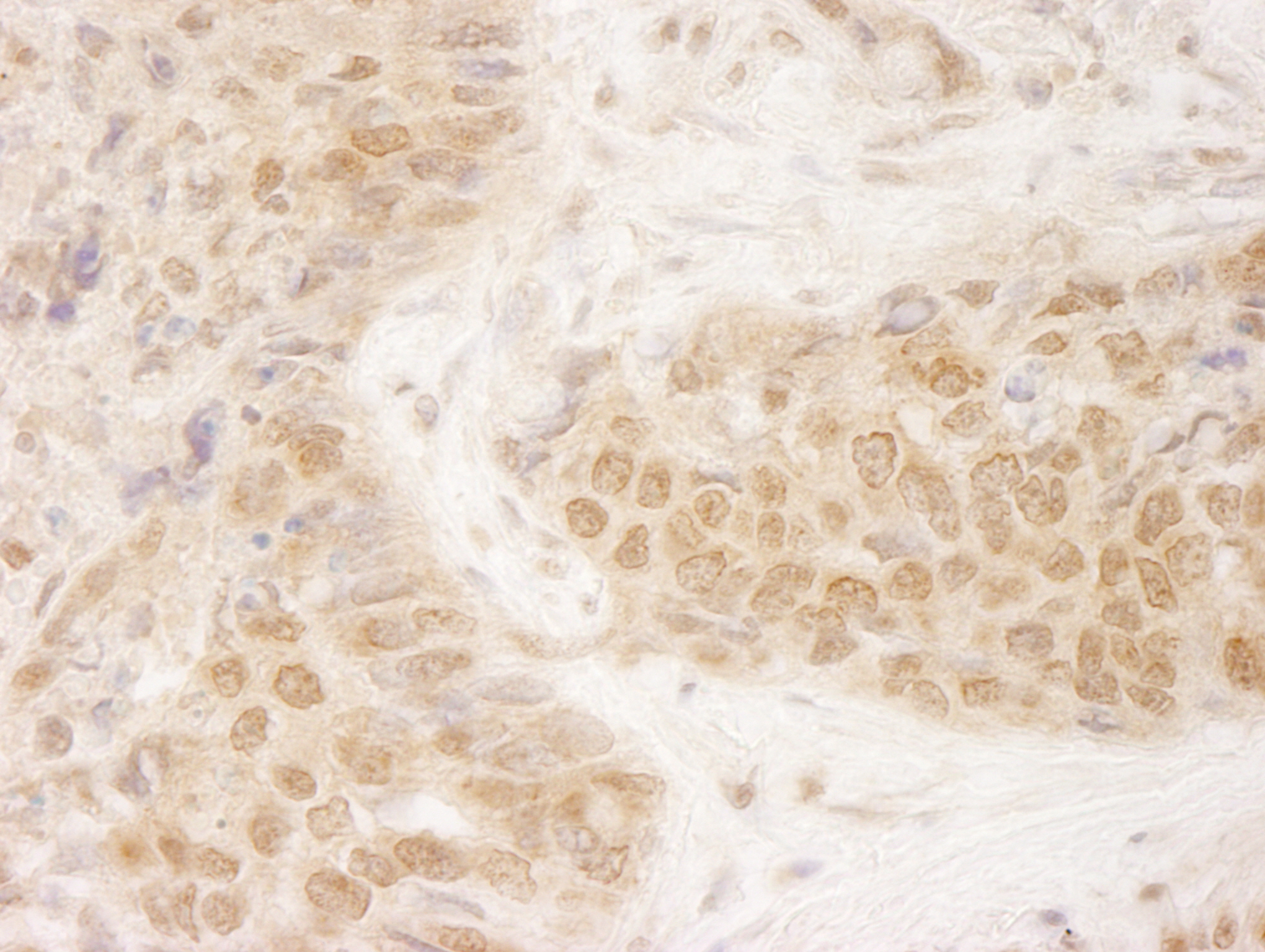 Rabbit anti-MCAK IHC Antibody