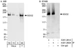 Detection of human SGO2 by western blot and immunoprecipitation.