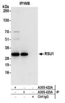 Detection of human RSU1 by western blot of immunoprecipitates.