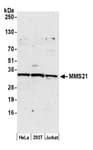 Detection of human MMS21 by western blot.