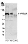 Detection of human PDXDC1 by western blot.