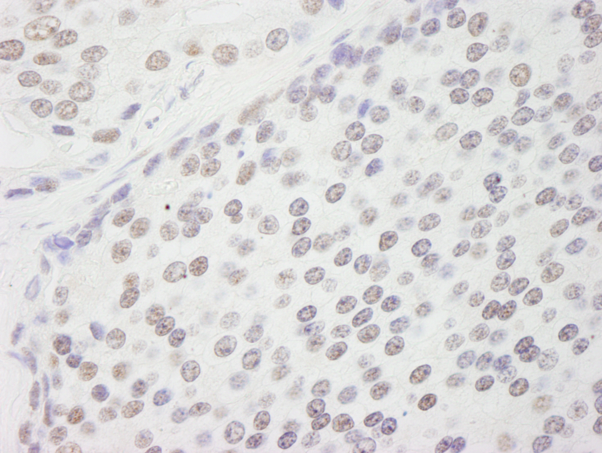 Rabbit anti-CPSF160 IHC Antibody