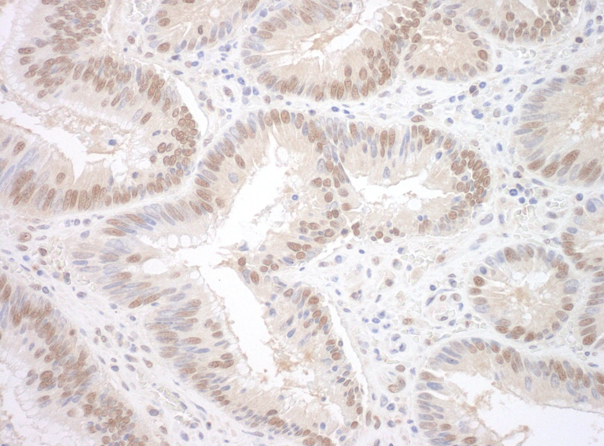 Rabbit anti-SPF45 IHC Antibody