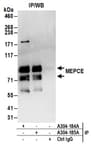 Detection of human MEPCE by western blot of immunoprecipitates.