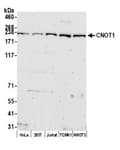 Detection of human and mouse CNOT1 by western blot.