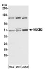 Detection of human NUCB2 by western blot.