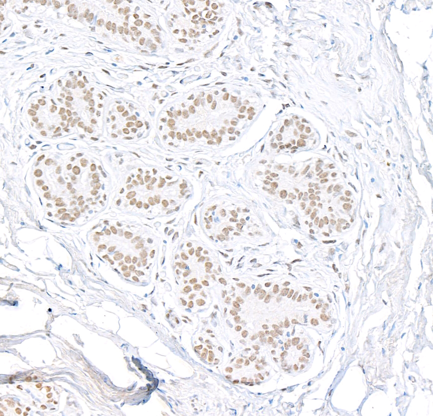 Detection of human E1B-AP5 by immunohistochemistry.
