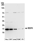 Detection of human and mouse REEP5 by western blot.