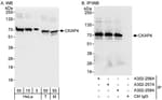 Detection of human and mouse CKAP4 by western blot (h&amp;m) and immunoprecipitation (h).