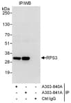 Detection of human RPS3 by western blot of immunoprecipitates.
