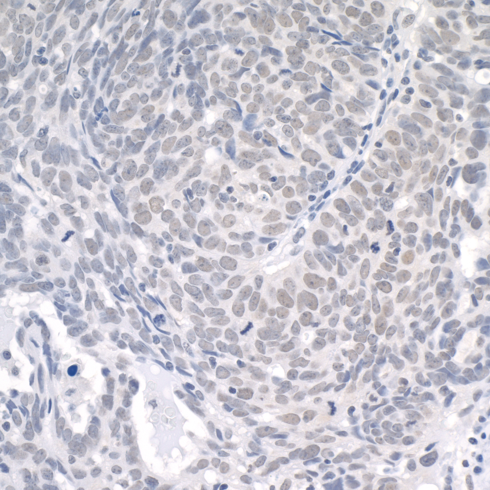 Rabbit anti-USP1 IHC Antibody