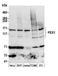 Detection of human and mouse PEX1 by western blot.