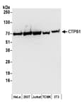 Detection of human and mouse CTPS1 by western blot.