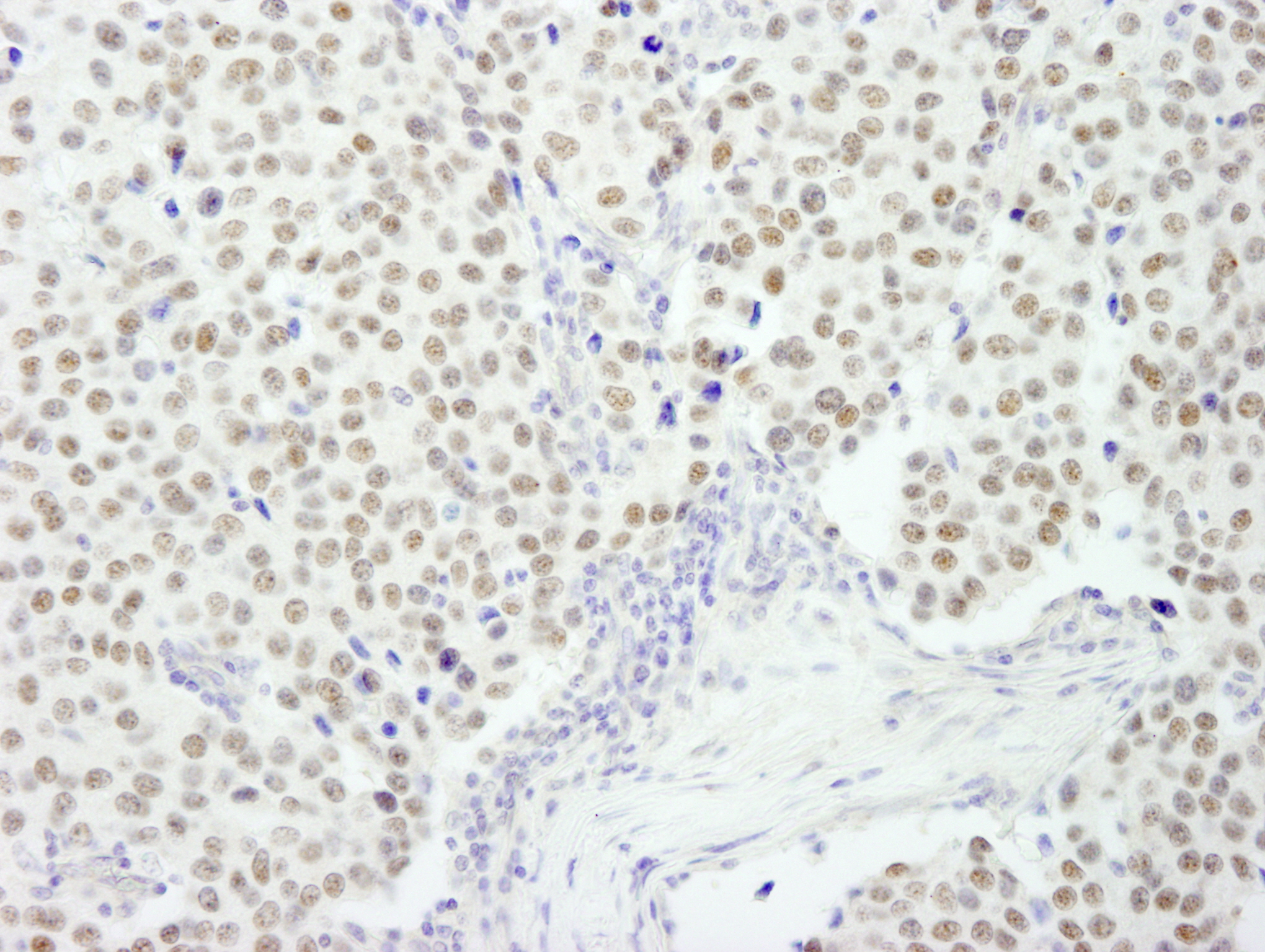 Rabbit anti-RCOR3 IHC Antibody