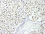 Detection of human RCOR3 by immunohistochemistry.