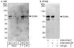 Detection of human and mouse DUBA by western blot (h&amp;m) and immunoprecipitation (h).