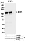 Detection of human EGFR by western blot of immunoprecipitates.