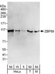 Detection of human and mouse ZBP89 by western blot.