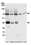 Detection of human MCT4 by western blot.